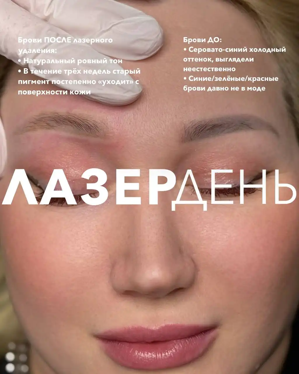 Лазерное удаление тату и татуажа в Барнауле - Лазерные процедуры (Красота и здоровье) в Барнаул