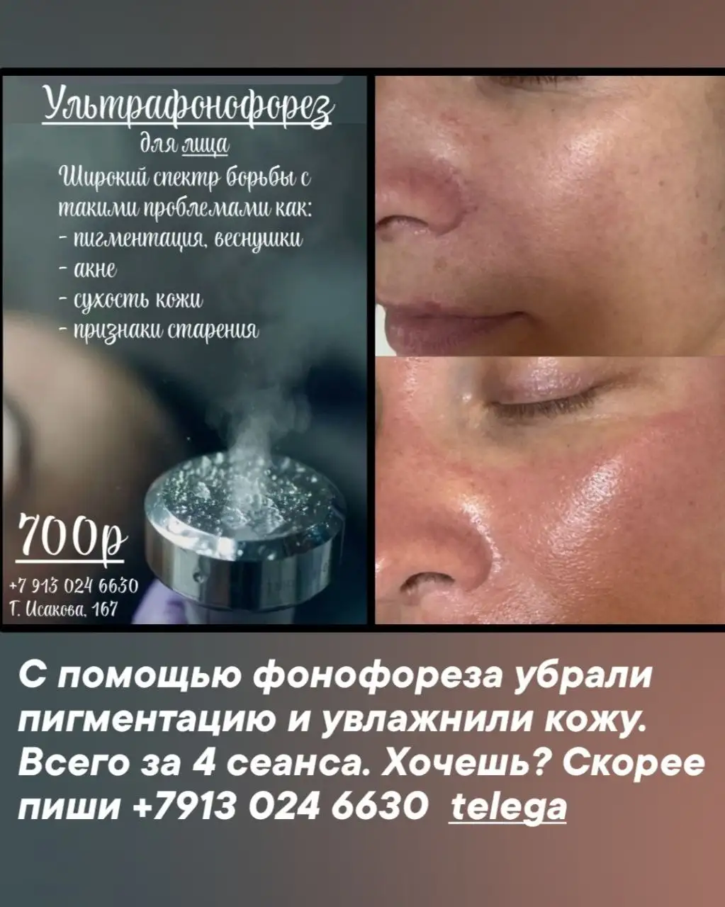 Стройность и красота в одном шаге - Красота и здоровье в Барнаул