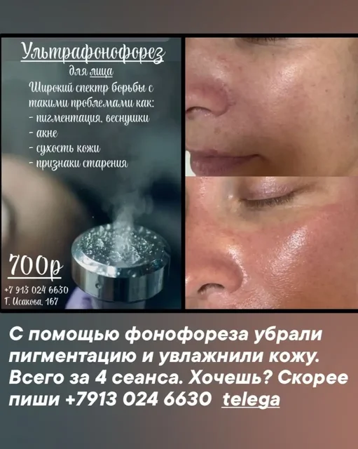 Стройность и красота в одном шаге - Ногтевой сервис в Барнаул