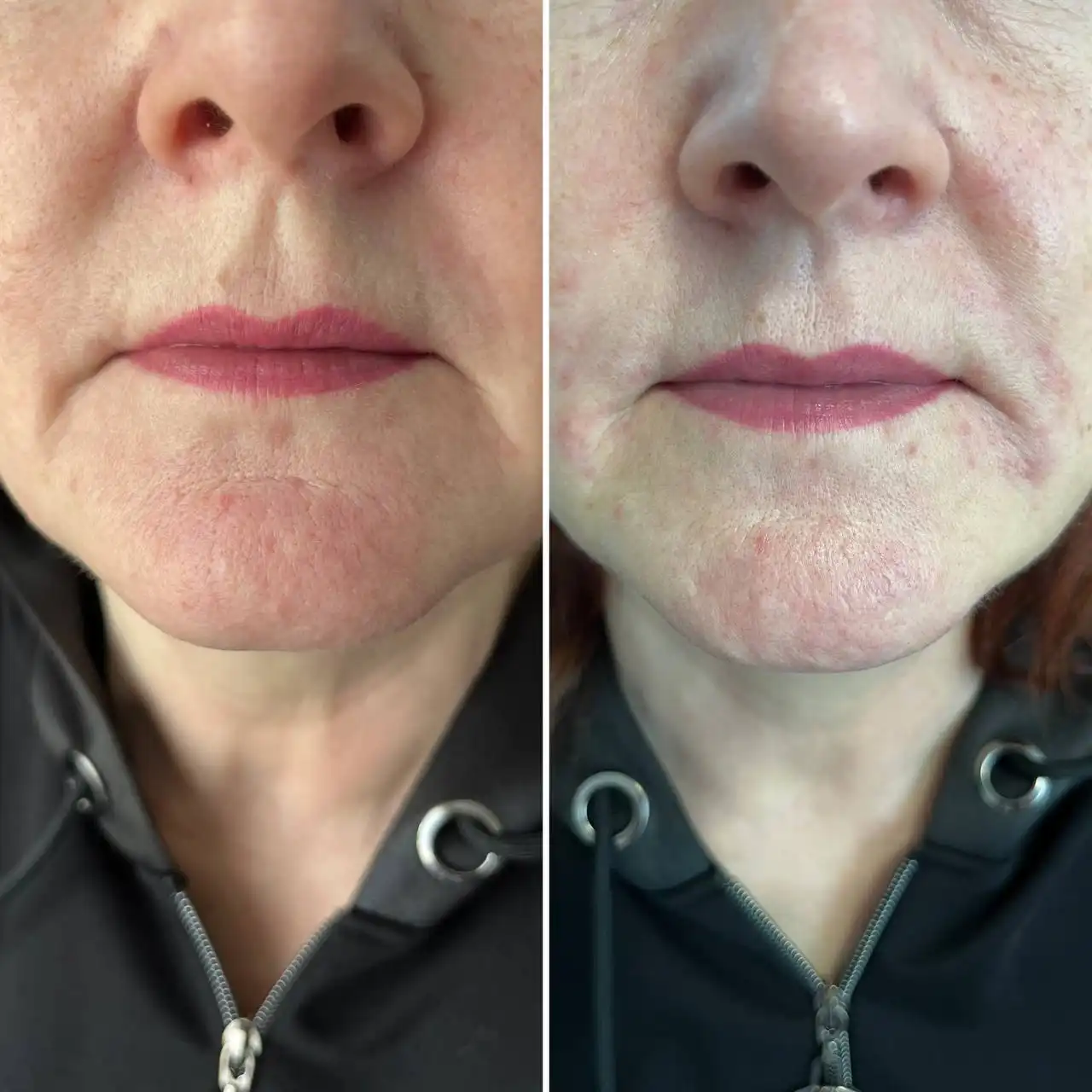 Косметологические услуги в Балашихе - Косметология (Услуги) в Балашиха