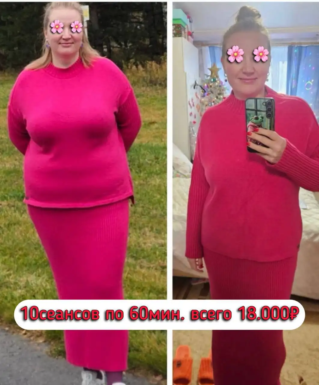 Услуги коррекции фигуры, лазерной эпиляции и массажа в студии - Красота и здоровье (Услуги) в Балашиха