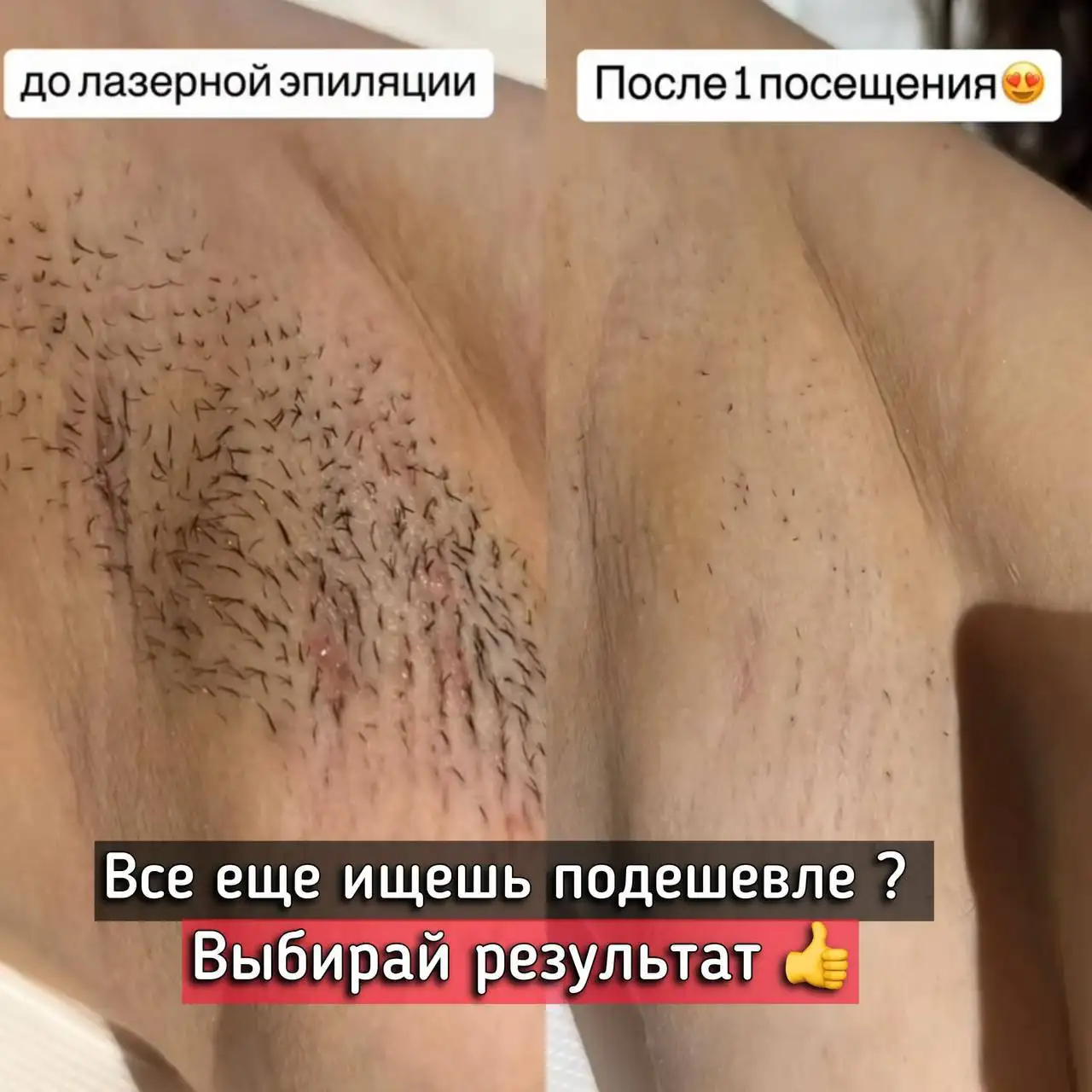 Услуги коррекции фигуры, лазерной эпиляции и массажа в студии - Красота и здоровье (Услуги) в Балашиха