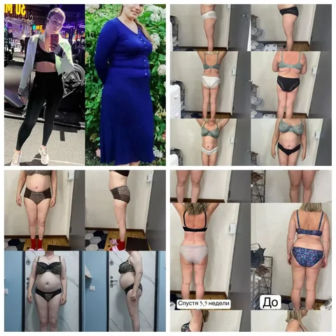 Услуги аппаратной косметологии и коррекции фигуры - Услуги в Владивосток