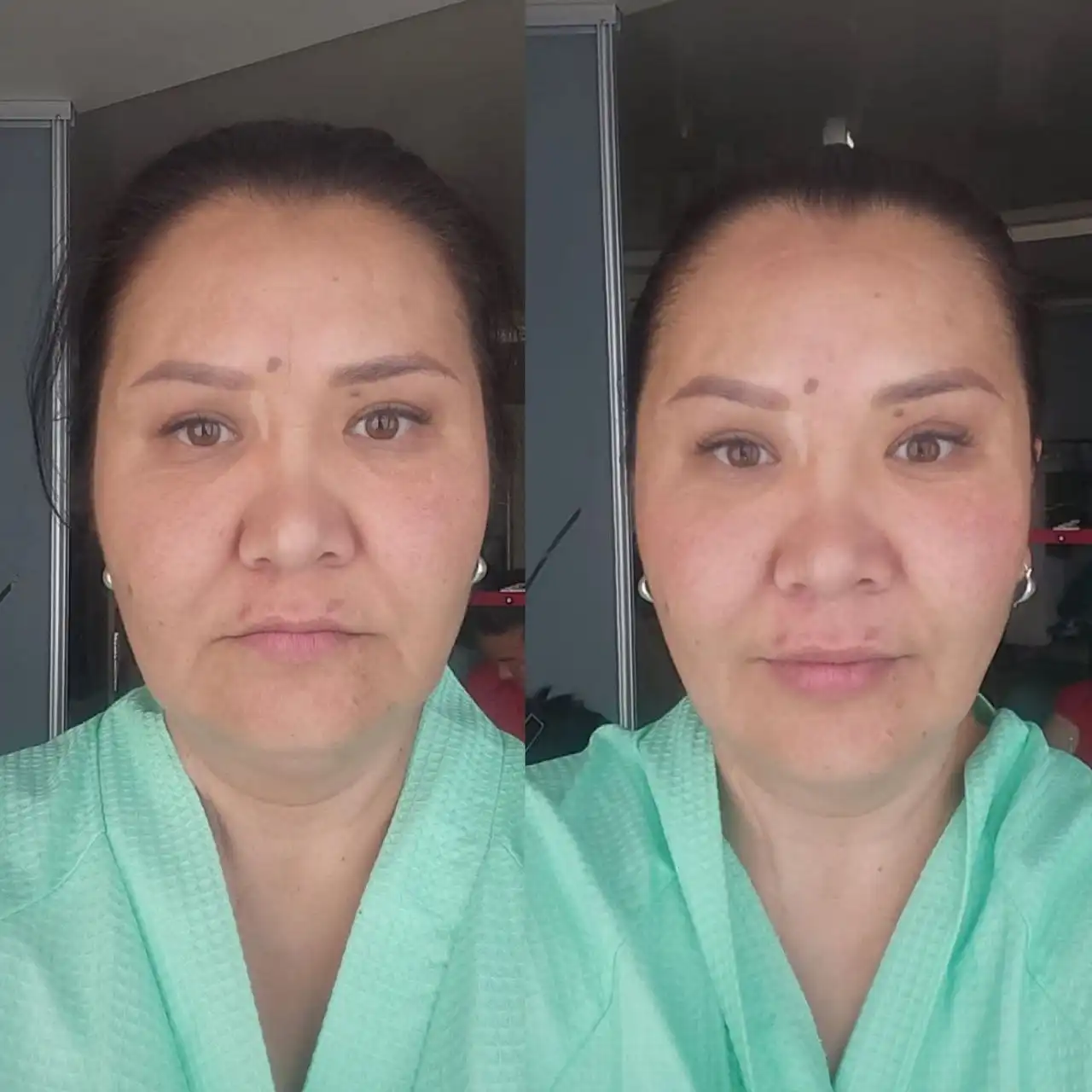 Массаж лица для омоложения