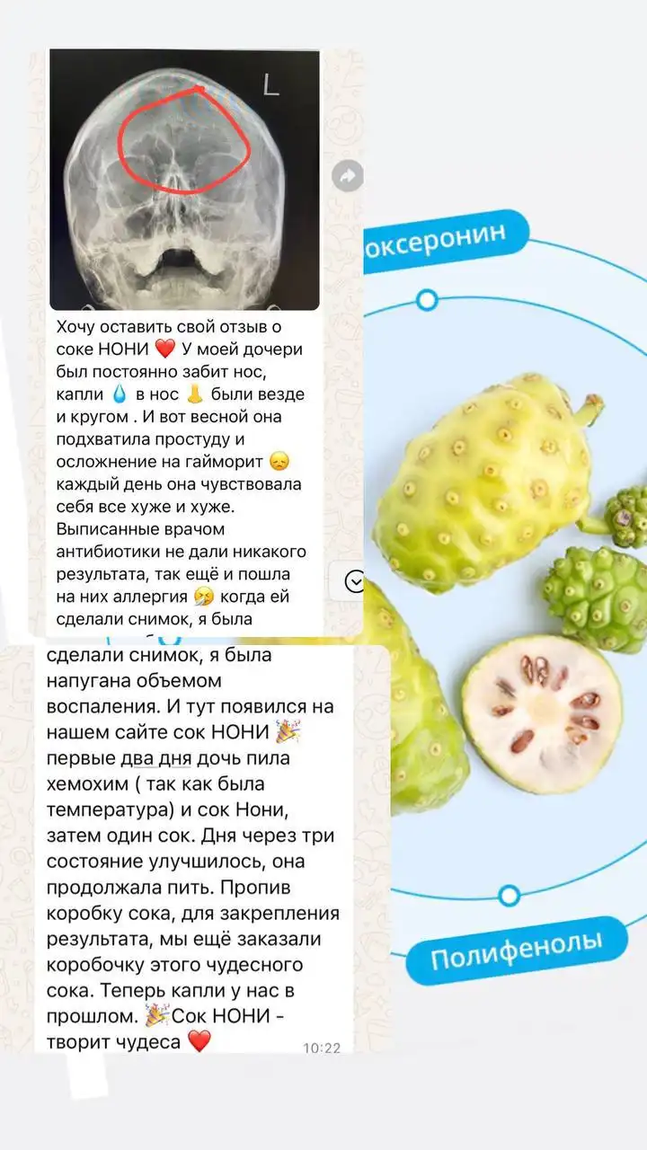 АТОМИ - возможность быть красивой и здоровой - БАД/косметика (Красота и здоровье) в Балашиха