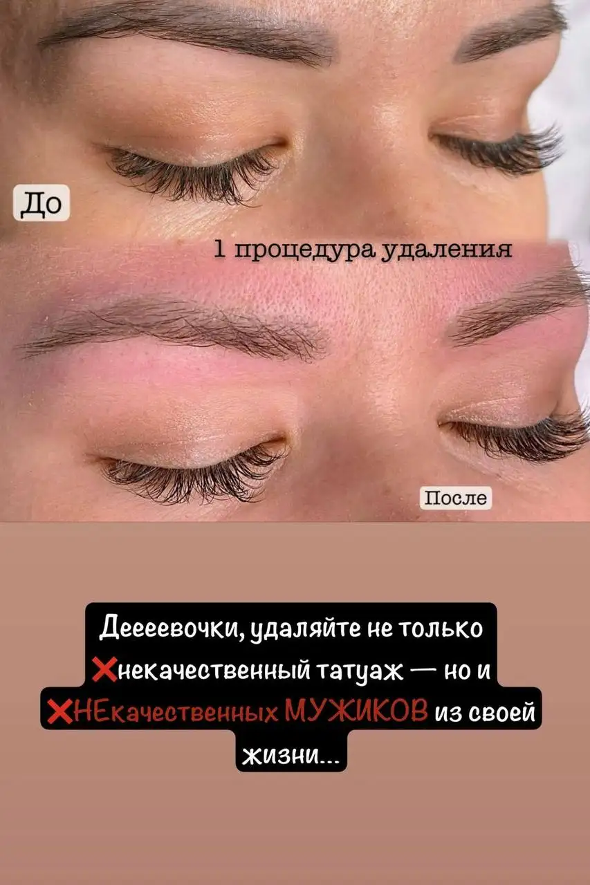 Услуги по татуажу и пилингу - Красота и здоровье (Услуги) в Москва