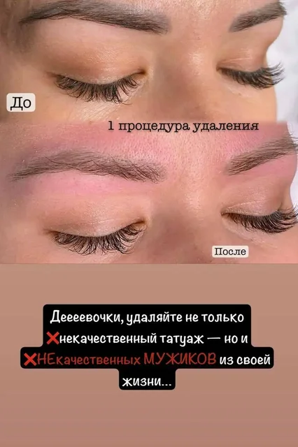 Услуги по татуажу и пилингу - Покупка банковских карт в Москва