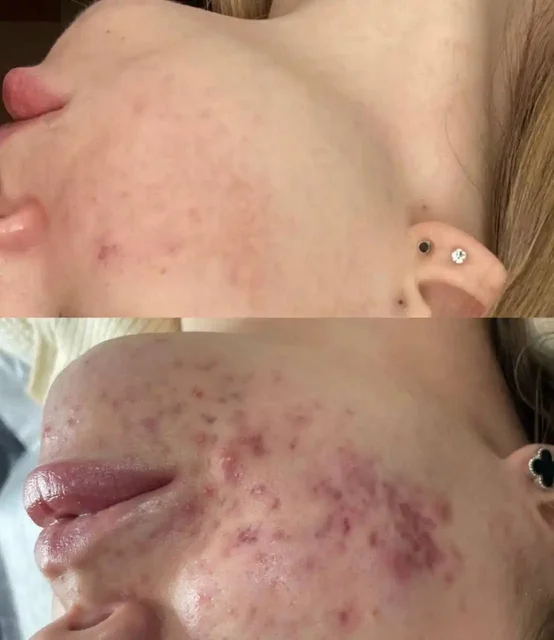 Система ухода за кожей: консультация, чистка и курс процедур - Автоуслуги в Чебоксары