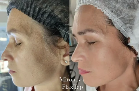 Уходовые омолаживающие процедуры в Чебоксарах - Автоуслуги в Чебоксары