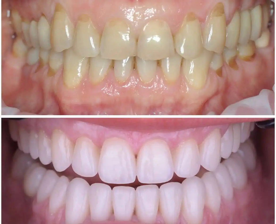 Услуги врача-стоматолога хирурга ортопеда - Медицинские услуги (Услуги) в Люберцы