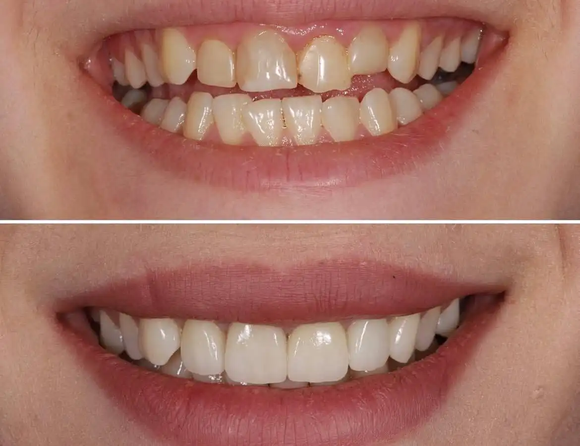 Услуги врача-стоматолога хирурга ортопеда - Медицинские услуги (Услуги) в Люберцы