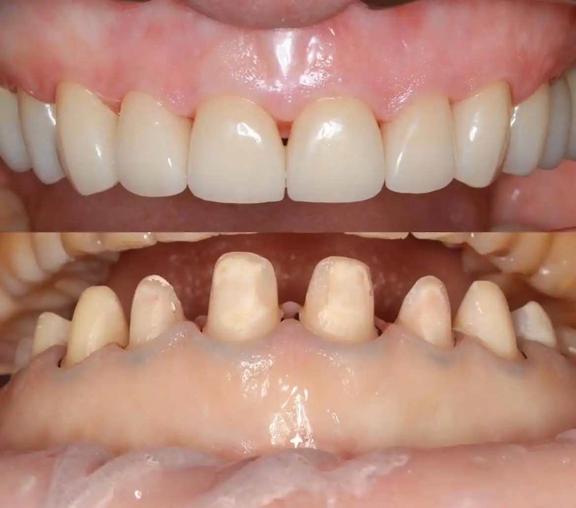 Услуги врача-стоматолога хирурга ортопеда - Медицинские услуги (Услуги) в Люберцы