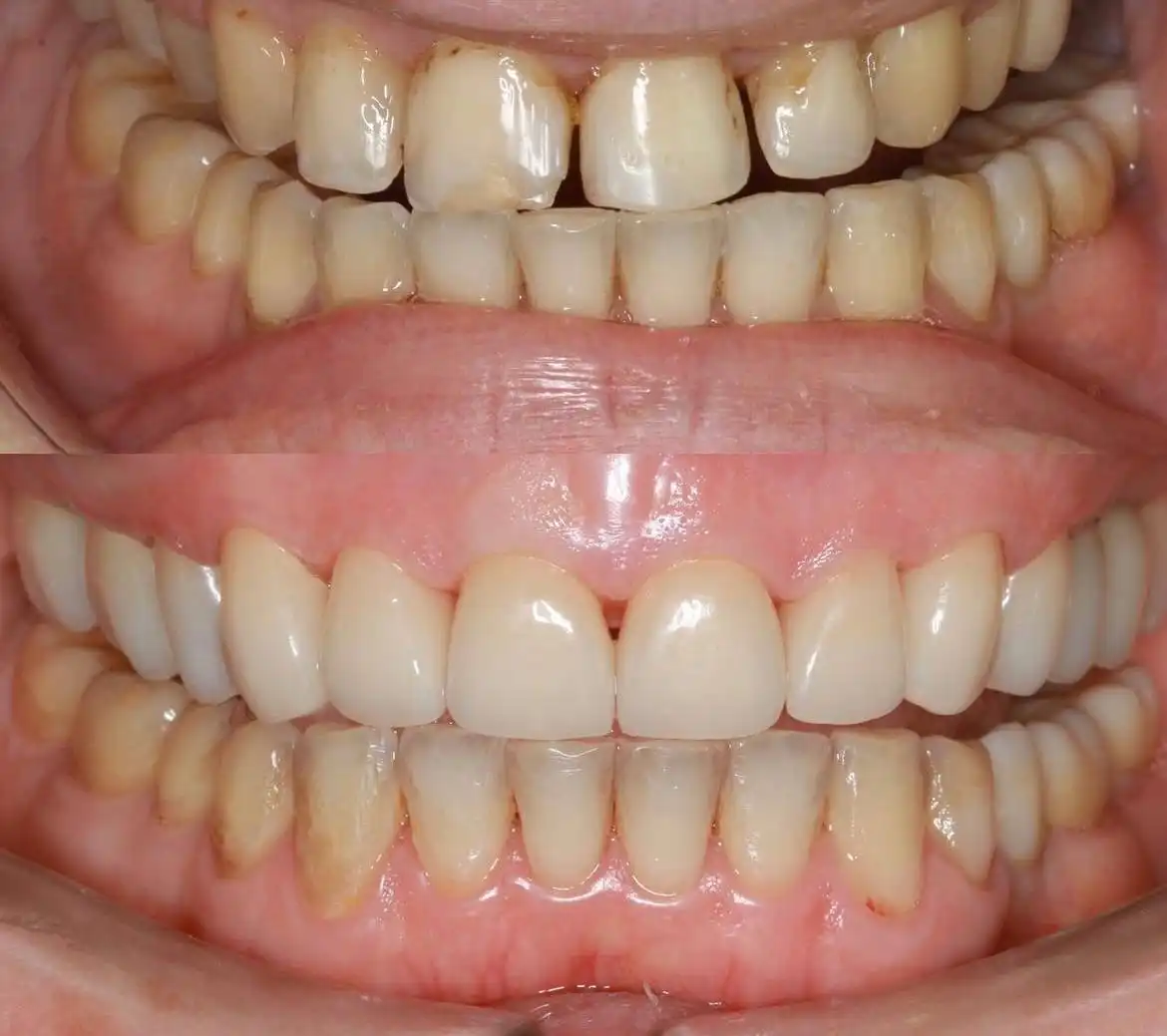 Услуги врача-стоматолога хирурга ортопеда - Медицинские услуги (Услуги) в Люберцы