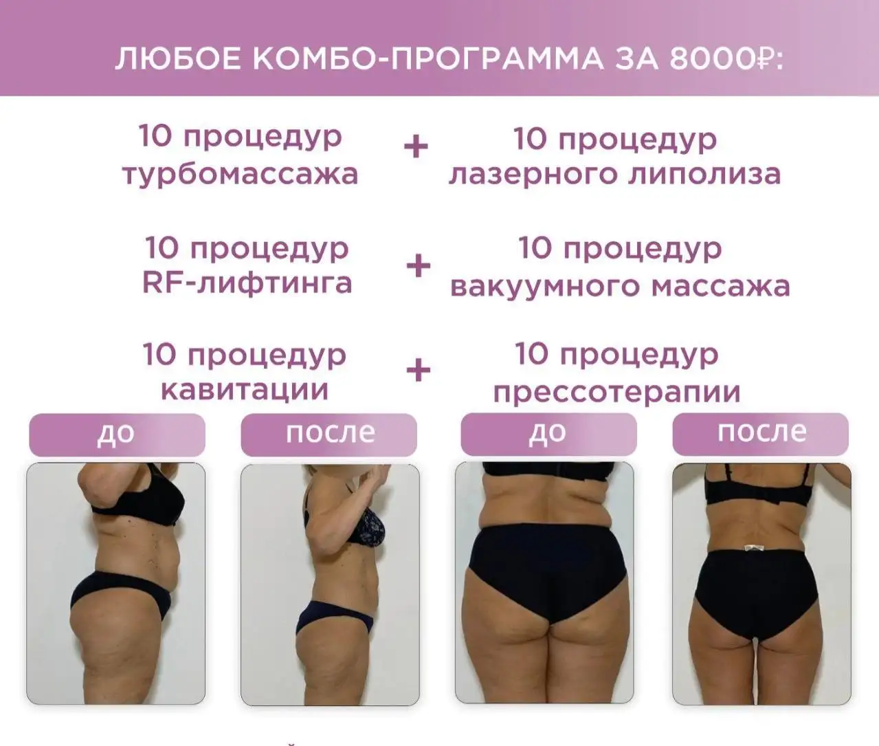 Абонементы на аппаратные процедуры в студии Дамсбург - Аппаратные процедуры (Красота и здоровье) в Тольятти