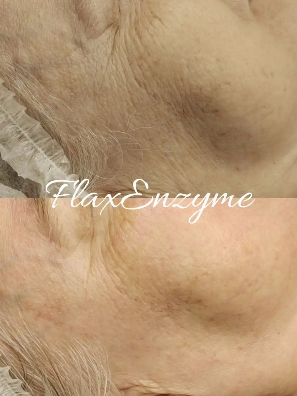 Отработка новой техники восстановления и омоложения кожи