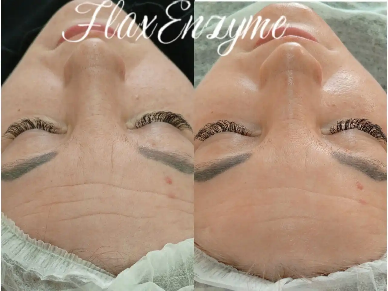 Отработка новой техники восстановления и омоложения кожи