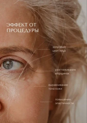 Микроиглы Dr. A’Gen для омоложения кожи - Красота и здоровье в Южно-Сахалинск