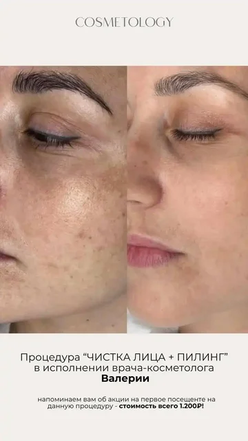 Акции января у врача-косметолога Валерии - Эфирные масла в Ульяновск