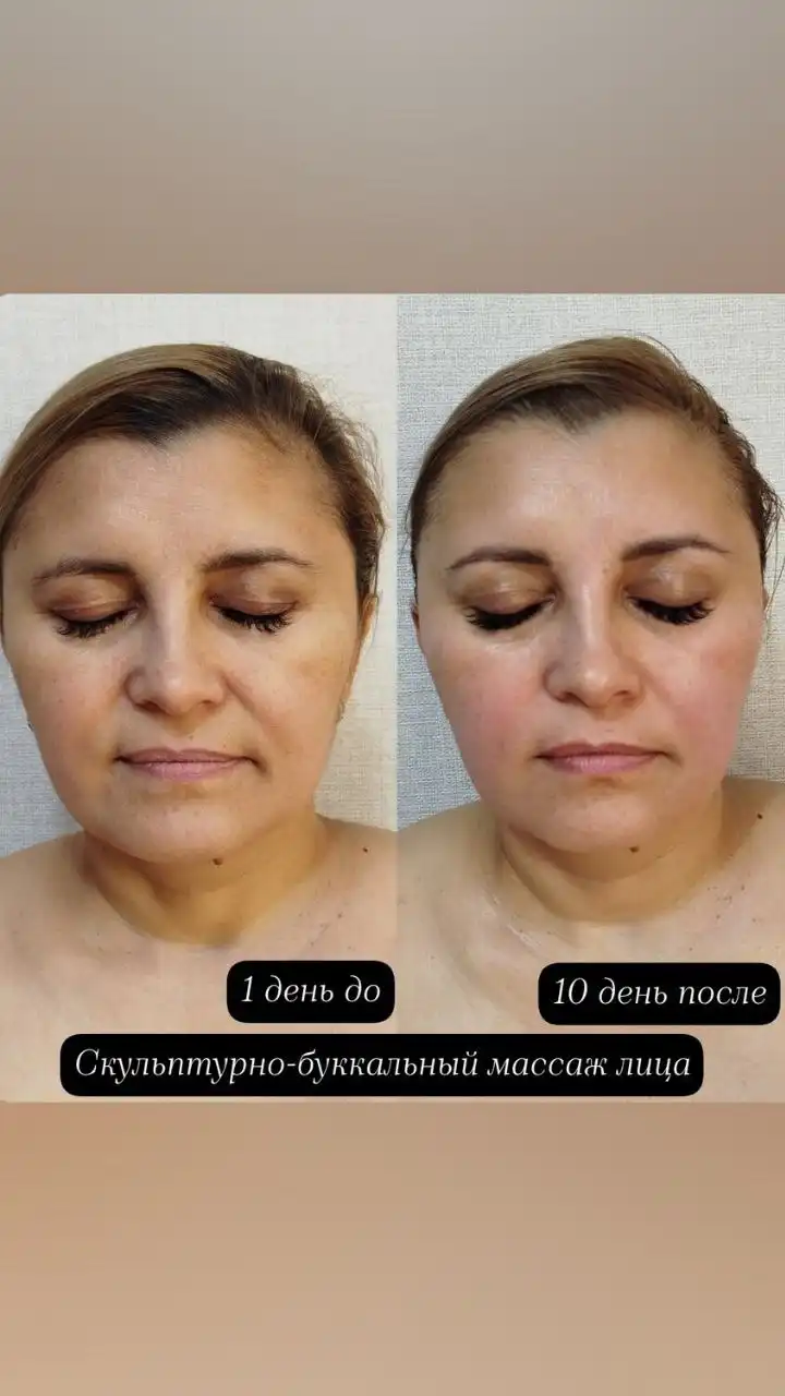 Буккальный массаж лица в Чите