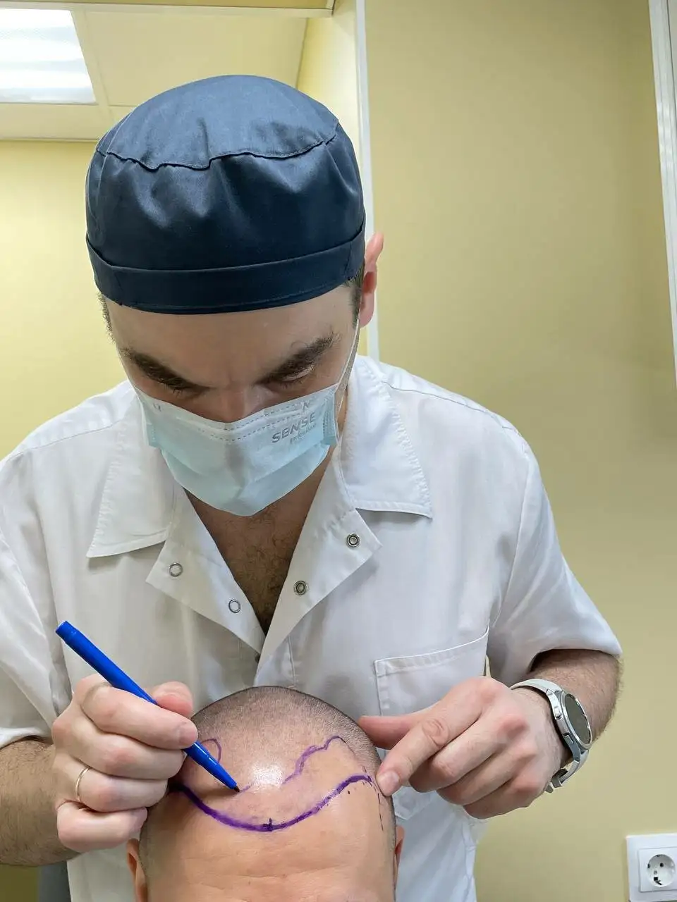 Трансплантация волос в Иркутске - Косметология/Медицинские услуги (Услуги) в Иркутск