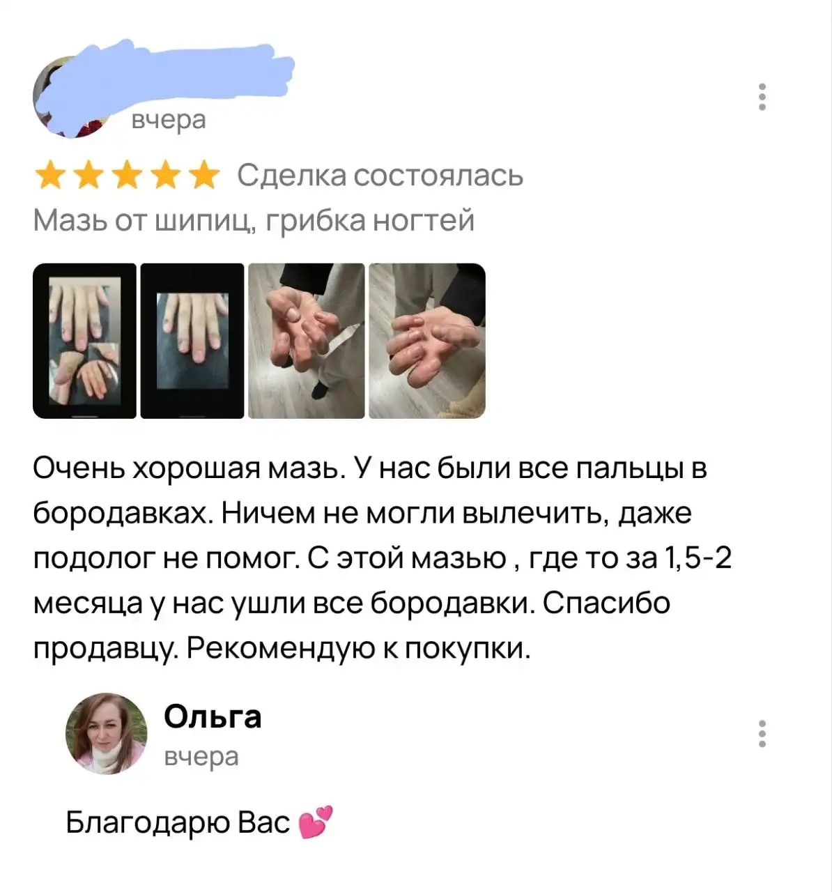 Мазь от грибка ногтей и кожных проблем