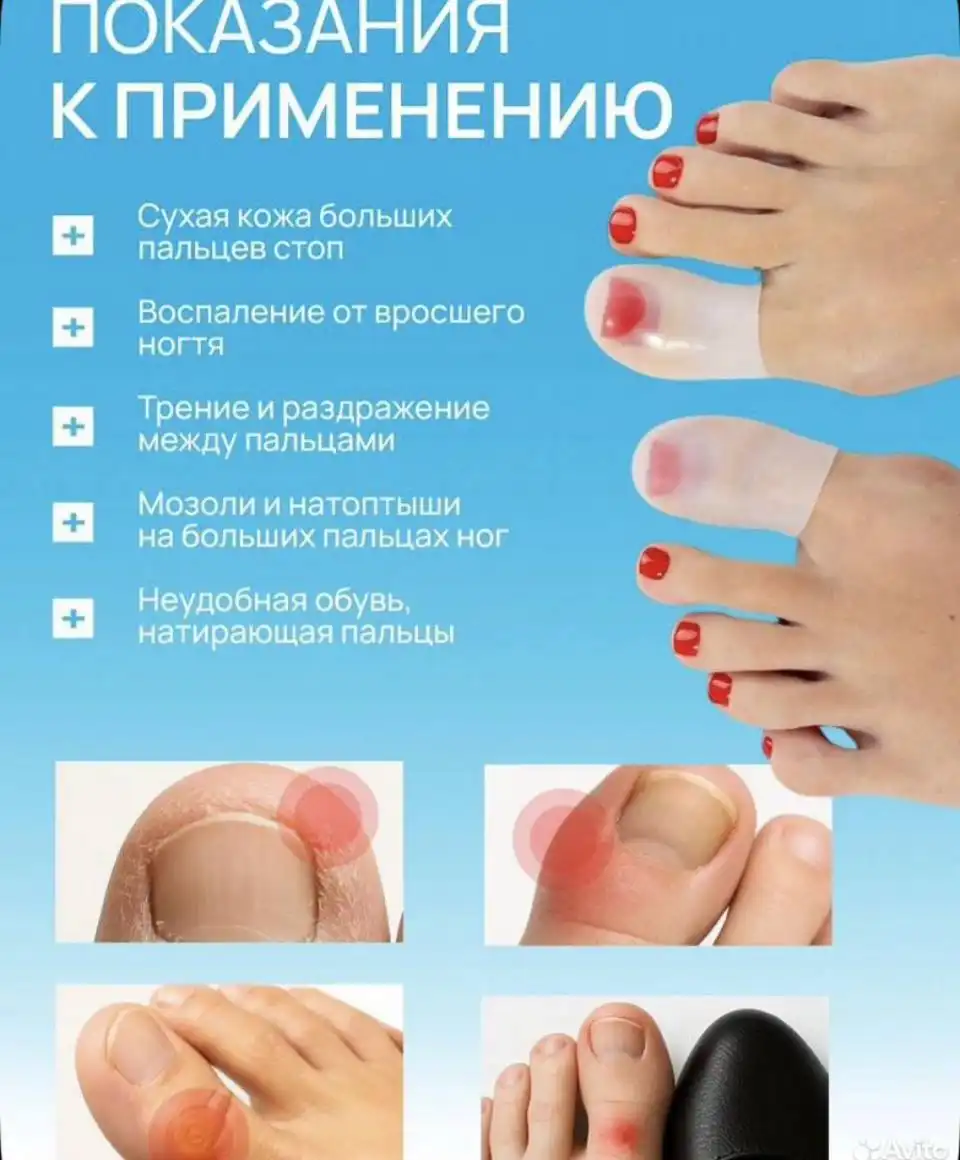Силиконовые напальчники на большой палец ног - Средства для ног (Красота и здоровье) в Бутово