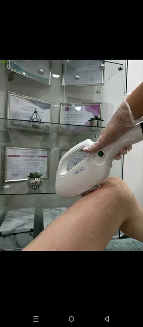 Лазерная эпиляция в Мытищах - Услуги в Мытищи