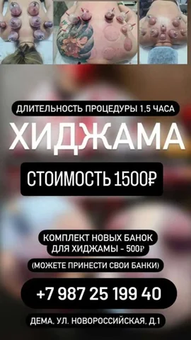 Хиджама: терапевтический эффект при различных заболеваниях - Полиграфические услуги в Уфа