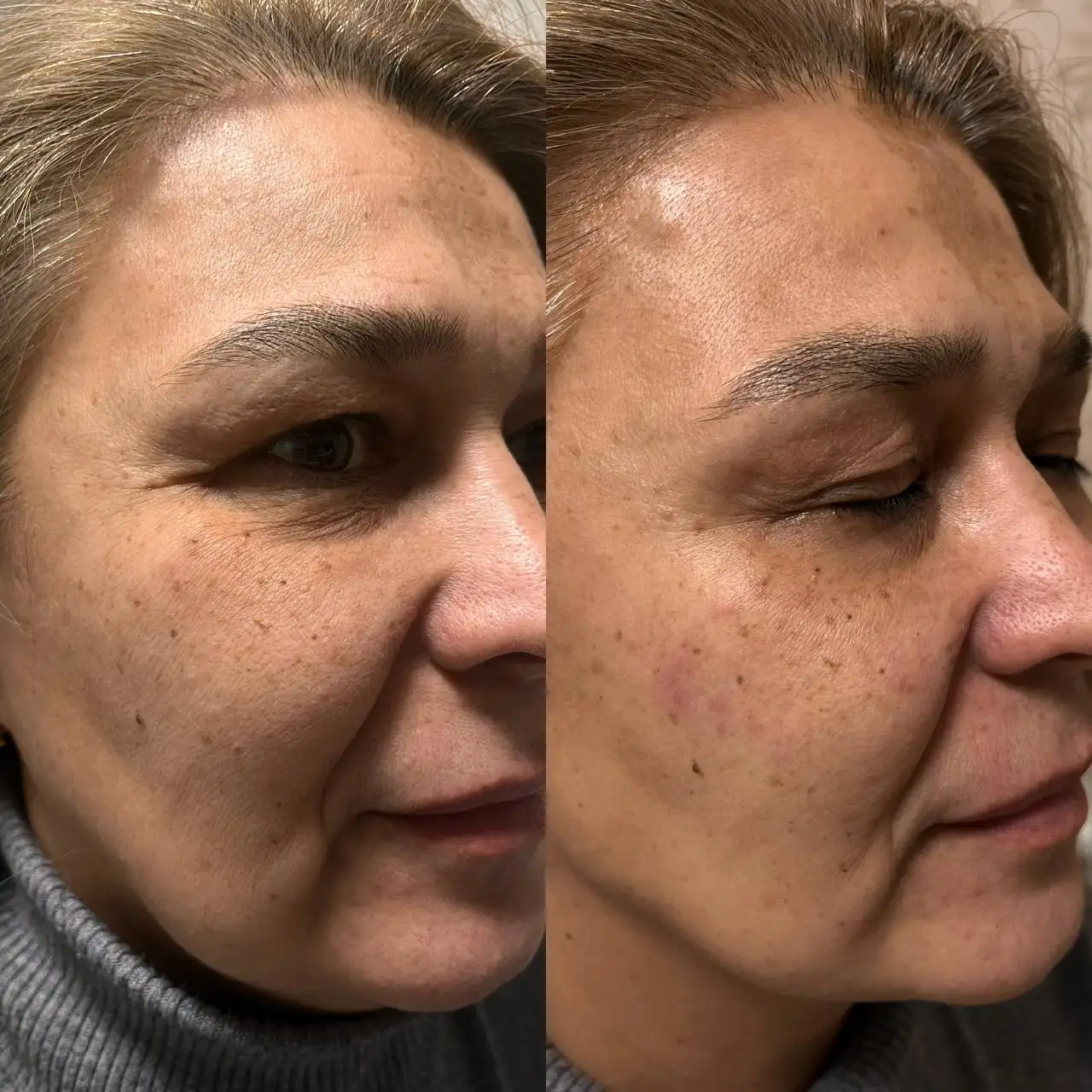 Косметологические процедуры от косметолога-эстетиста - Косметология (Услуги) в Уфа