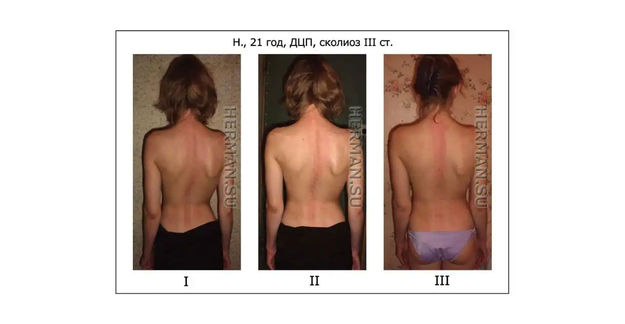 Услуги костоправа в Энгельсе - Медицинские услуги (Услуги) в Энгельс