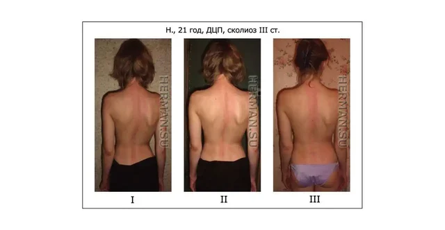 Услуги костоправа в Энгельсе - Услуги в Энгельс