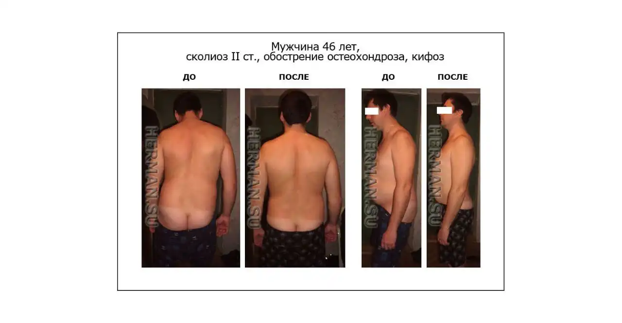 Услуги костоправа в Энгельсе - Медицинские услуги (Услуги) в Энгельс