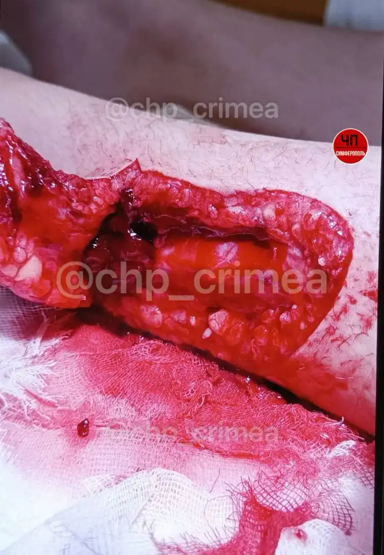 Происшествие с ребёнком в симферопольском ТЦ - Барахолка в Симферополь