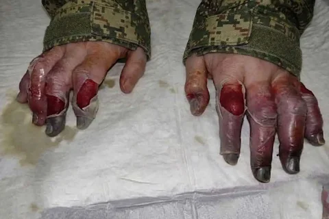 Руки русского солдата после двух недель на передовой - Барахолка в Новокузнецк