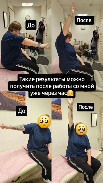 Кинезиолог и тренер ЛФК: диагностика и лечение хронической боли - Услуги в Химки