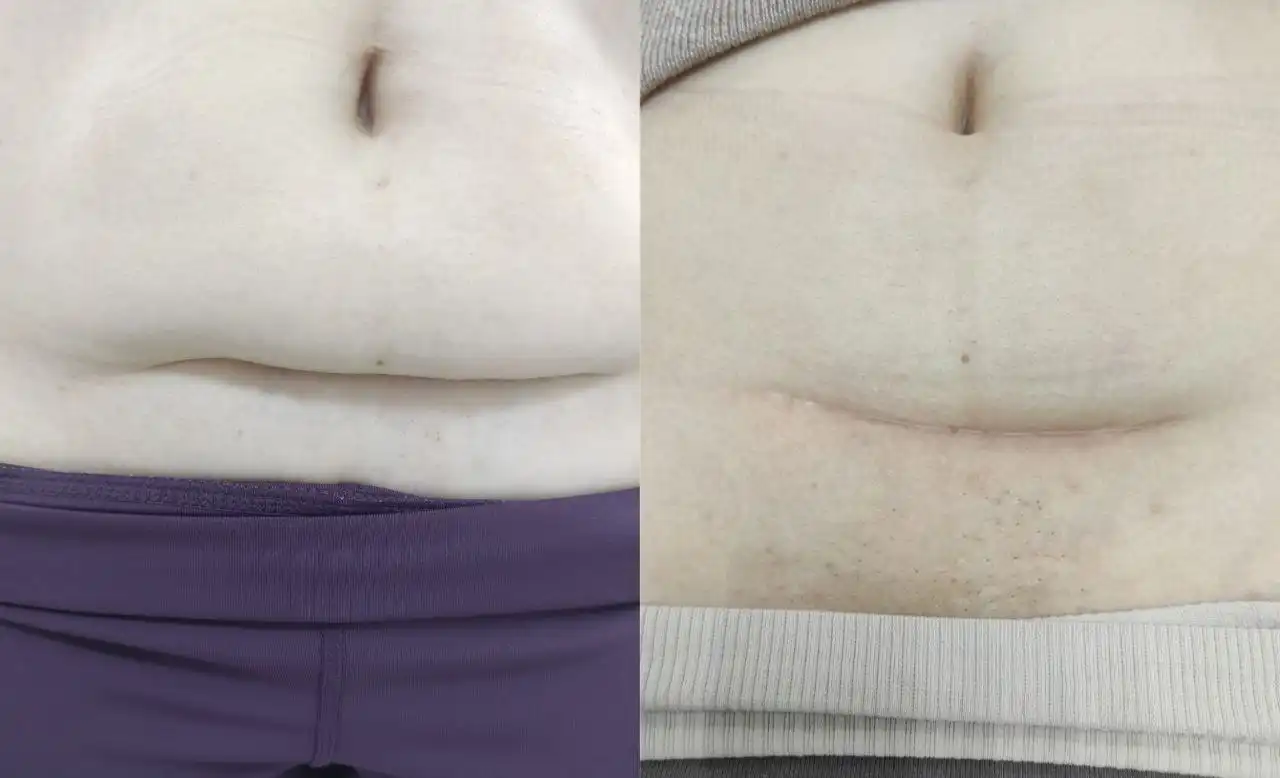 Кинезиолог и тренер ЛФК: диагностика и лечение хронической боли