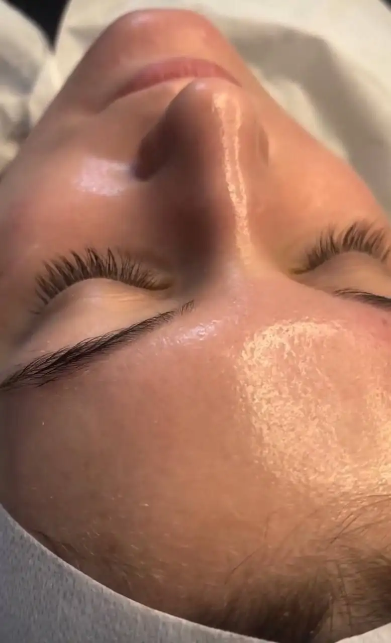 Комплексная чистка кожи лица 9 шагов - Косметологические услуги (Красота и здоровье) в Чебоксары