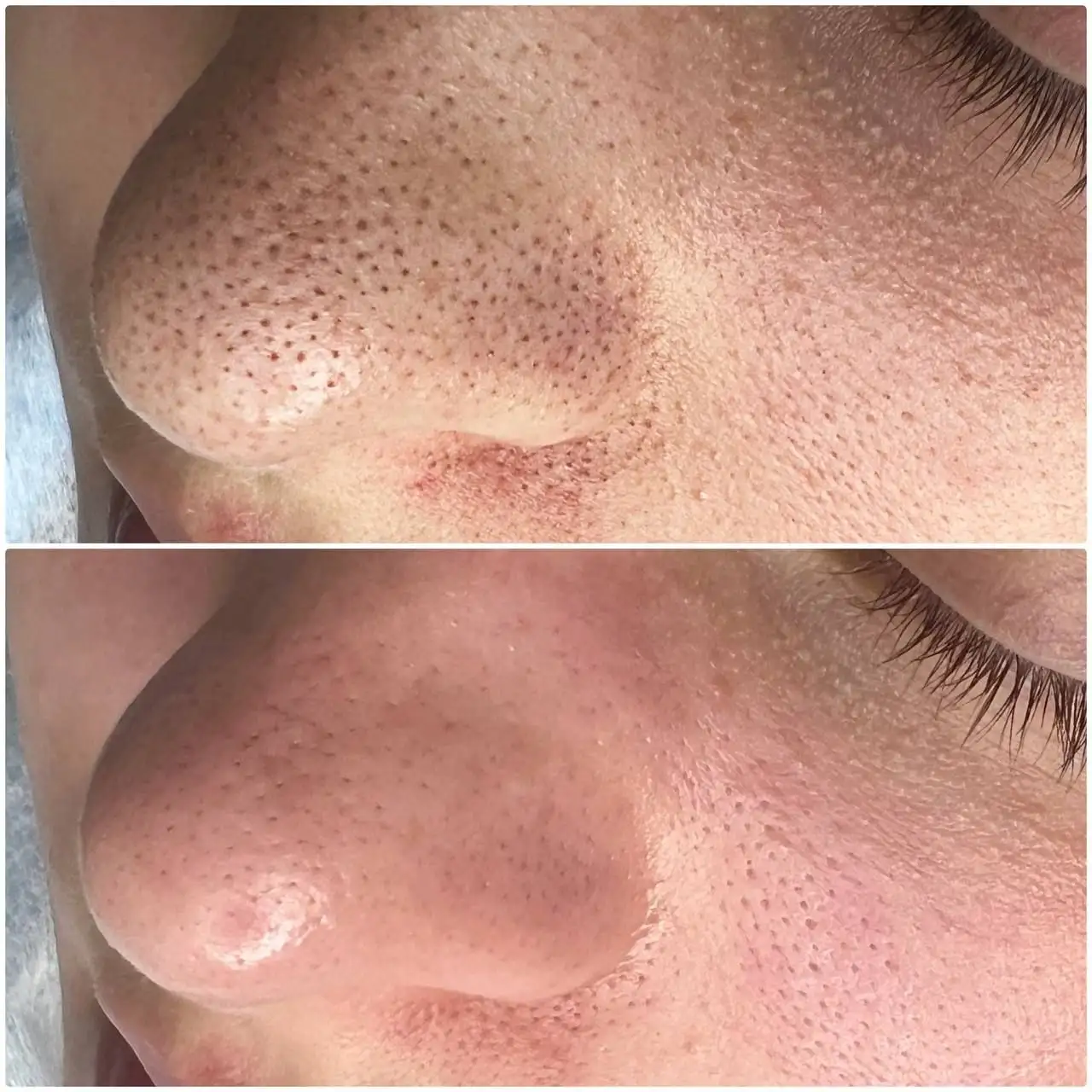 Комплексная чистка кожи 9 шагов от GIGI - Услуги косметолога (Красота и здоровье) в Чебоксары