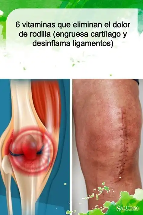 Лечение суставов и боли в ногах - Лекарства и препараты (Красота и здоровье) в Владивосток