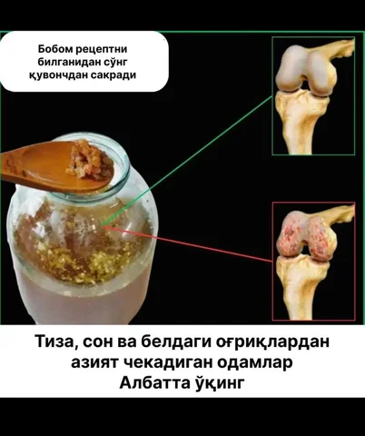 Sustavpromax-12 для лечения суставов - Красота и здоровье в Уфа