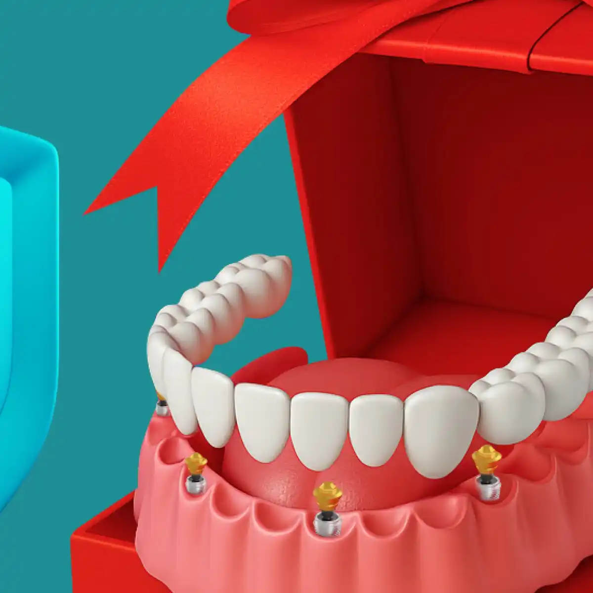 Имплантация зубов за 30 минут в Казани