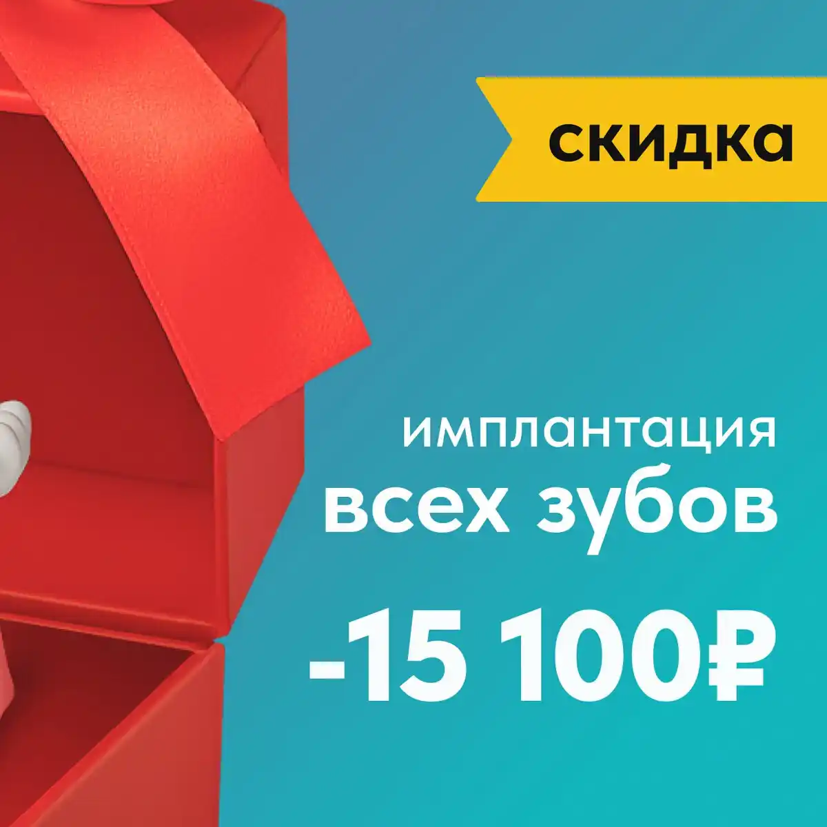 Имплантация зубов за 30 минут в Казани