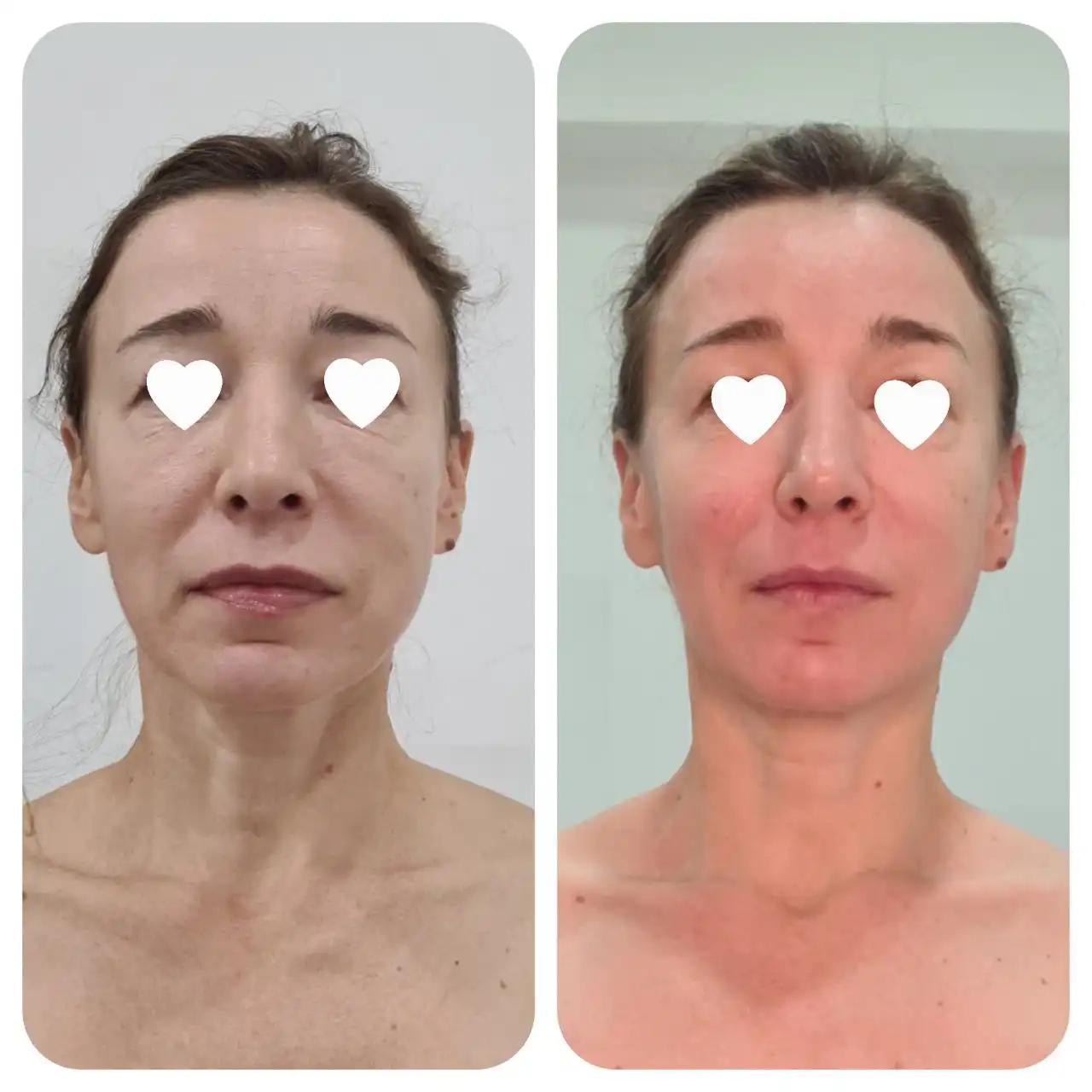 Массаж для сохранения молодости лица - Красота и здоровье (Услуги) в Краснодар