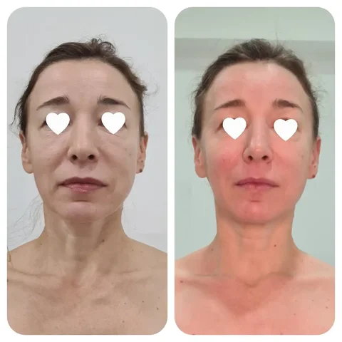 Массаж для сохранения молодости лица - База отдыха в Краснодар