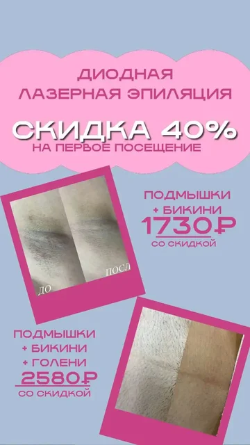 Удаление волос диодным лазерным аппаратом со скидкой 40% - Перманентный макияж в Краснодар