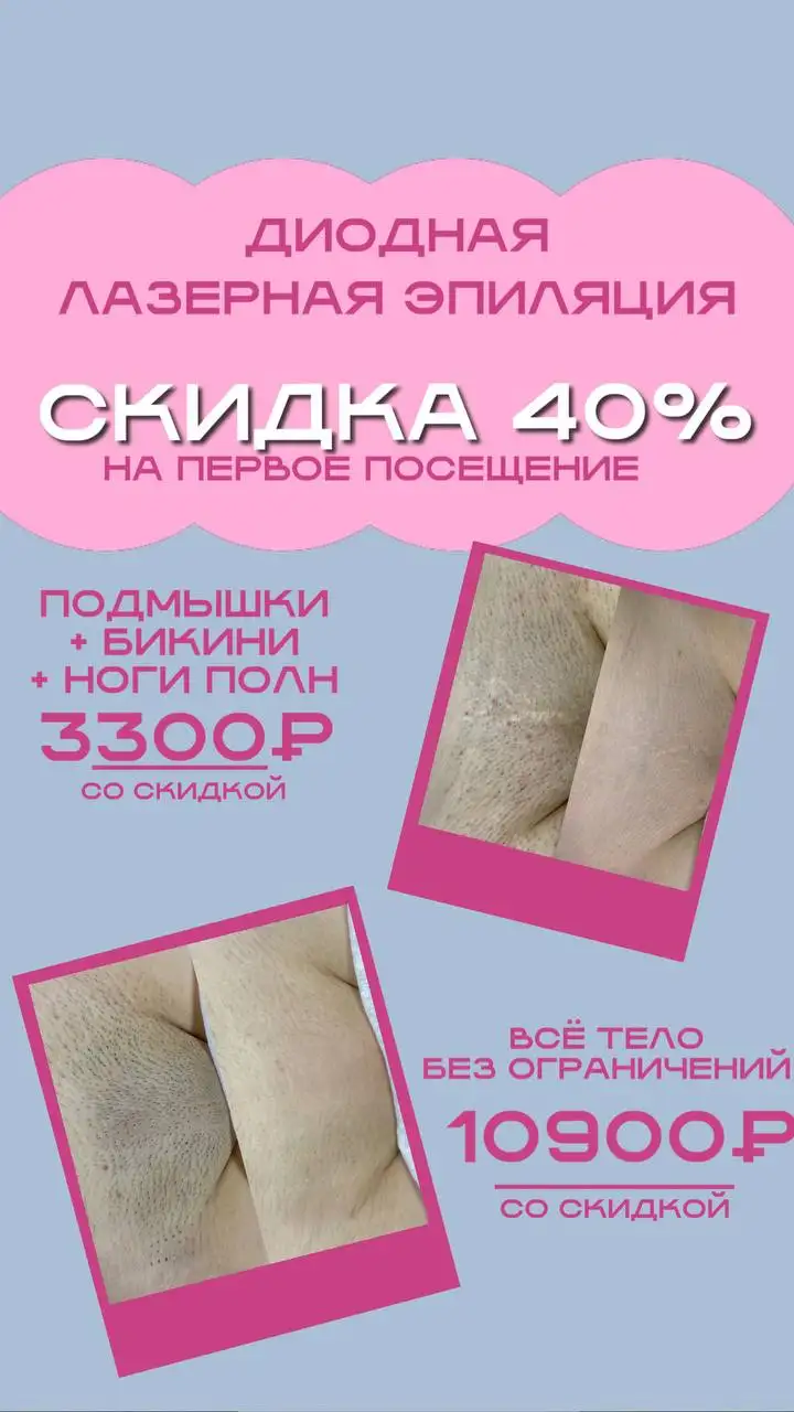 Удаление волос диодным лазерным аппаратом со скидкой 40% - Удаление волос (Красота и здоровье) в Краснодар