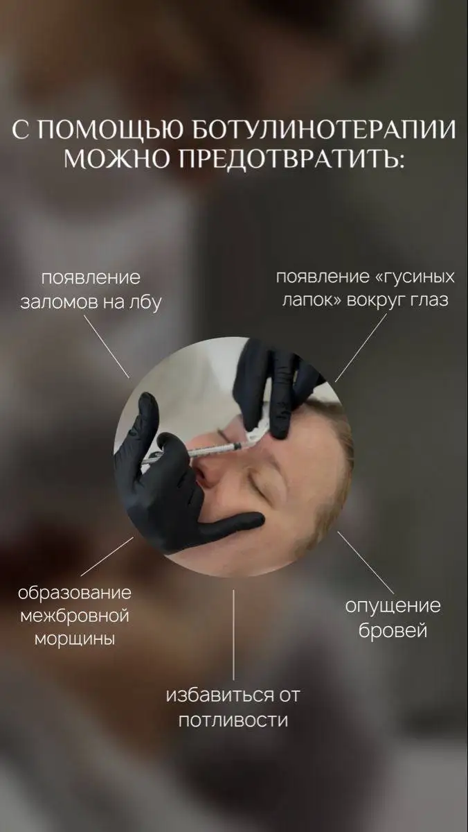 Ботокс и гипергидроз в Краснодаре - Косметология (Красота и здоровье) в Краснодар