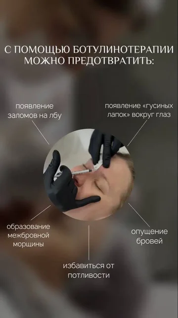 Ботокс и гипергидроз в Краснодаре - Красота и здоровье в Краснодар