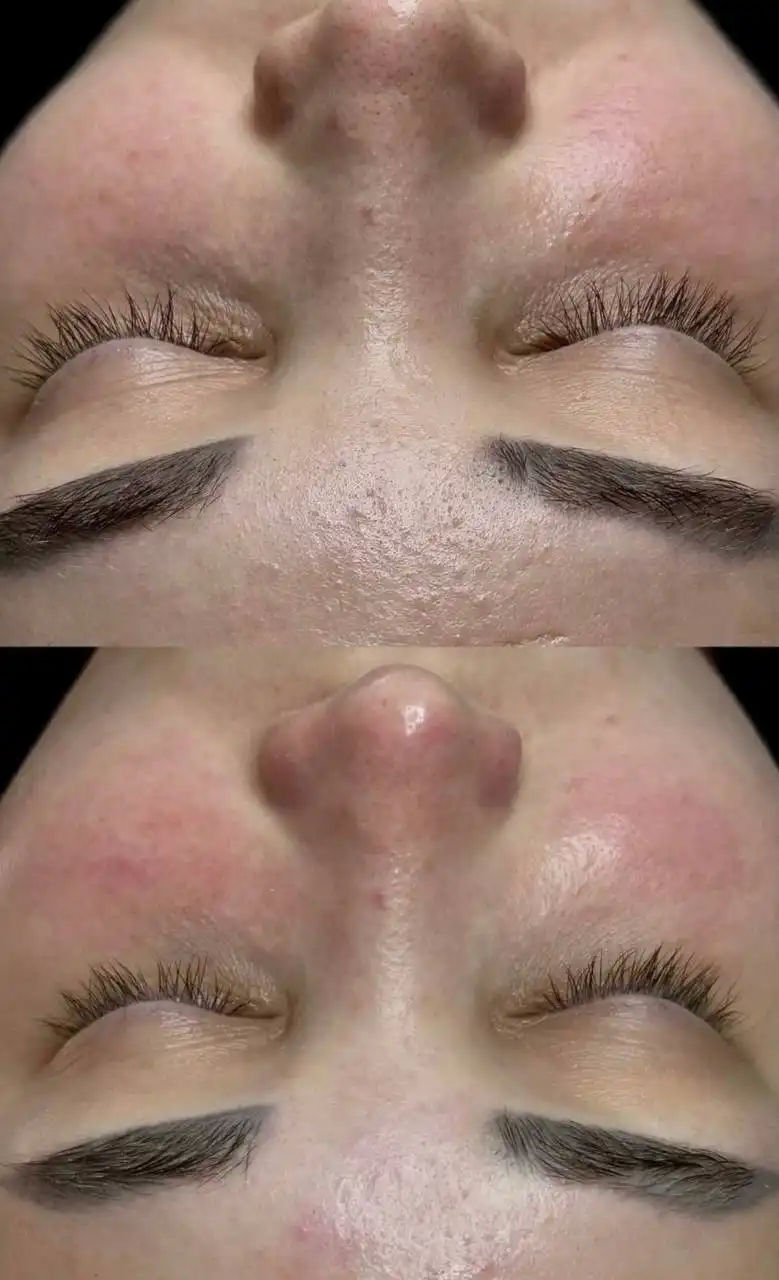 Услуги косметолога в Свердловском районе