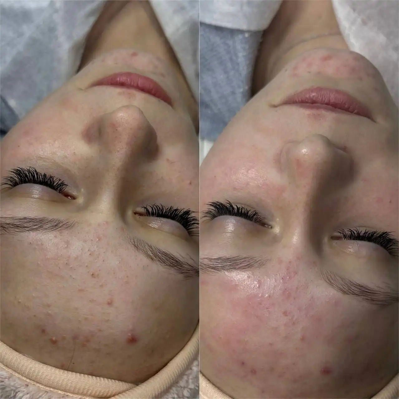 Услуги косметолога в Свердловском районе